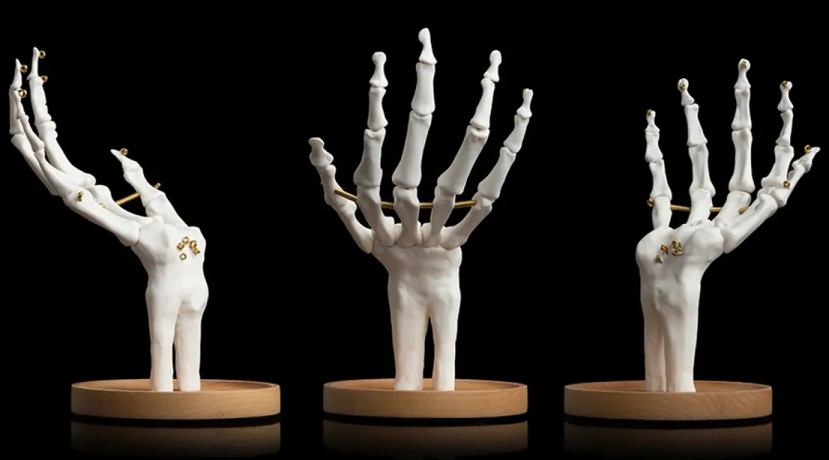 Skeleton Jewellery Tidy